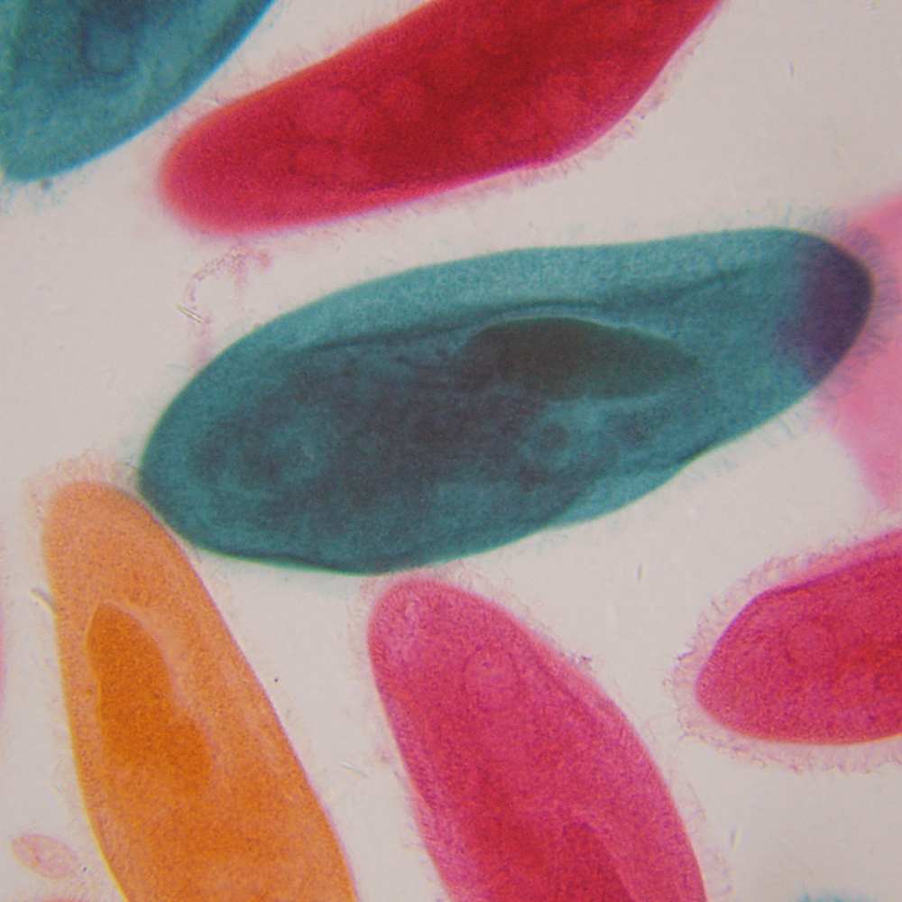 Paramecium viewed through a microscope at 40x
